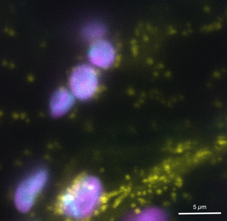 Mitochondria and chloroplasts in Nicotiana benthamiana leaf cells.