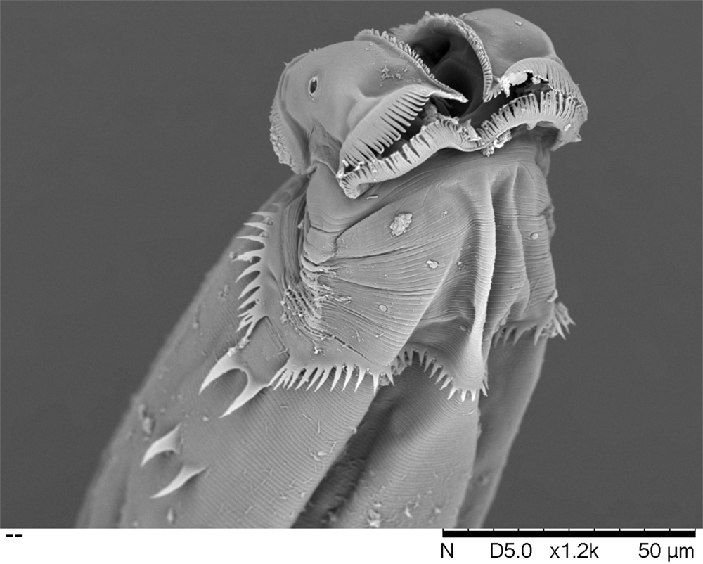 Scanning electron micrograph of Heth pivari, a new species of nematode (roundworm) that inhabits the intestine of an indigenous millipede, Narceus gordanus, from the Ocala National Forest in Florida. The nematode feeds on the bacteria living in the gut of the millipede. The image shows a female individual with characteristic cervical structures and lateral spines.